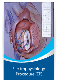 Electrophysiology procedure (EP)