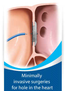 Minimally invasive surgeries for hole in the heart